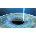 accuratis Augenlaser & Augenzentrum