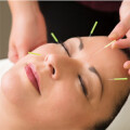 Akupunktur Praxis Dr. Anli Wang Akupunktur