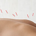 Akupunkturpraxis Li Fang