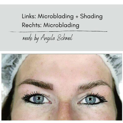 Brauenrekonstruktion