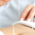Bild: Dr.med. Aischa Baumeister Fachärztin für Physikalische und Rehabilitative Medizin in Mönchengladbach