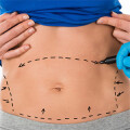 Dr.med. Alexander P. Hilpert Facharzt für Plastische- und Ästhetische Chirurgie