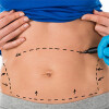 Bild: Dr.med. Janken Hoffmann Fachärztin für Plastische- und Ästhetische Chirurgie