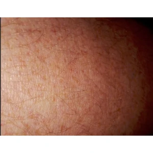 Dr.med. Martin Korn Facharzt für Orthopädie