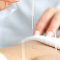 Dr.med. Ying Zhang Praxis für Akupunktur