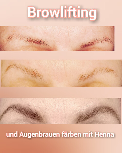 Browlifting