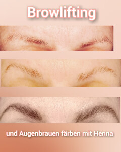 Browlifting