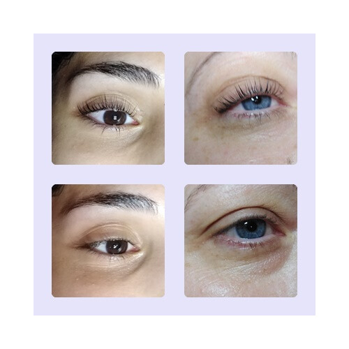 Lash-Lifting