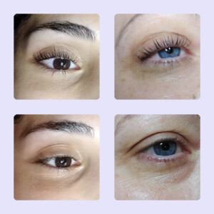 Lash-Lifting