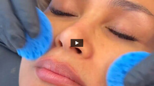 hydrafacial-platinum.mp4