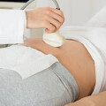 Mammographie-Screening Dr. med. Norbert Uleer