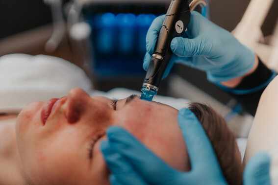 Hydrafacial-Behandlung Mann im Kosmetikstudio von Margarita M. Cosmetics in Remscheid