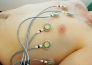 EKG