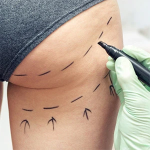 Novolinea Klinik für ästhetisch-plastische Chirurgie