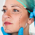 Plastische Chirurgie am Feuersee
