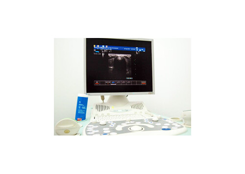 Ultraschalluntersuchung-Sonographie