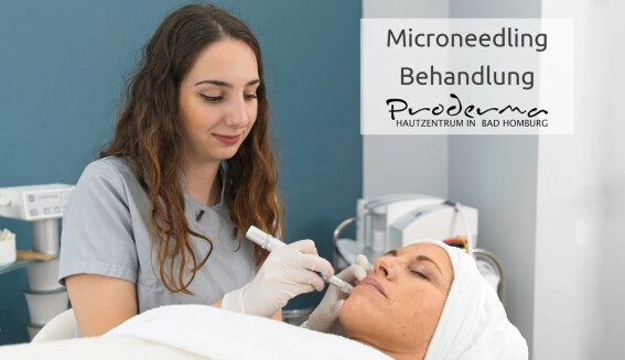 Mikroneedling Behandlung