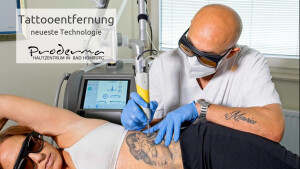 Tattooentfernung neueste Technologie