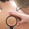 Bild: Prof.Dr.med. Eckhart Kämpgen Facharzt für Dermatologie