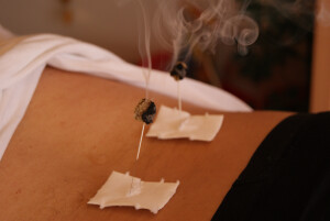 Moxatherapie Akupunktur
