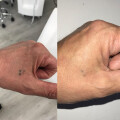 Bild: Skin Perfect GmbH in Mechernich
