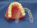 Invisalign